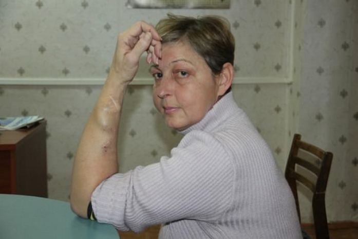 Жительница Костаная нуждается в срочном леченииЭксклюзив