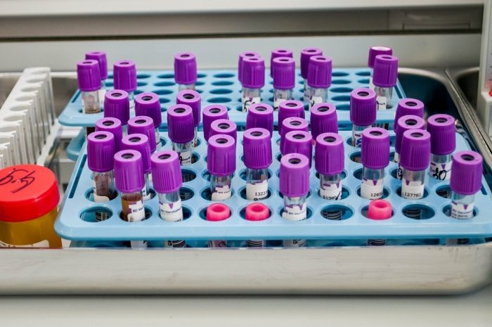 Выявляющие COVID-19 тест-системы разработаны в Казахстане