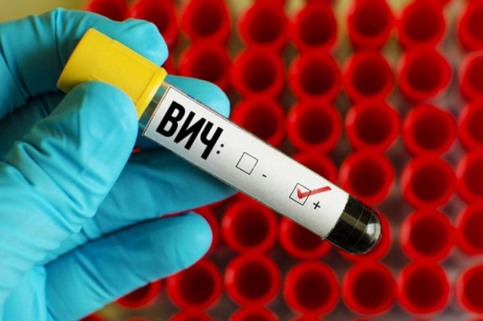 ВОЗ назвала Россию лидером по темпу распространения ВИЧ