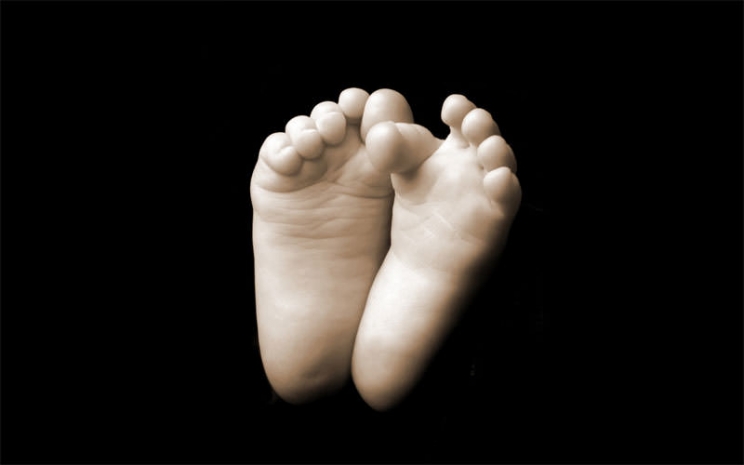 Хирург по ошибке прооперировал ребенку не ту ногу