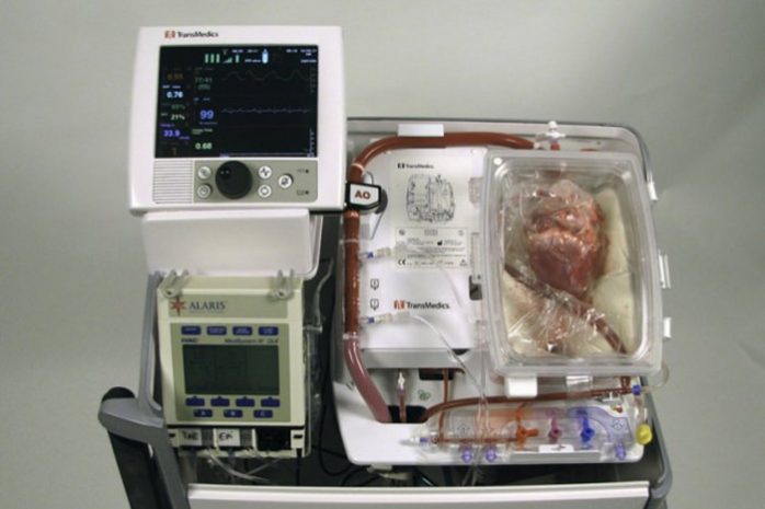 Хирурги впервые пересадили «мертвое» сердце