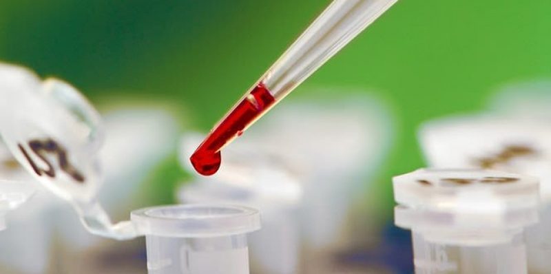 Самый опасный штамм ВИЧ найден в Африке