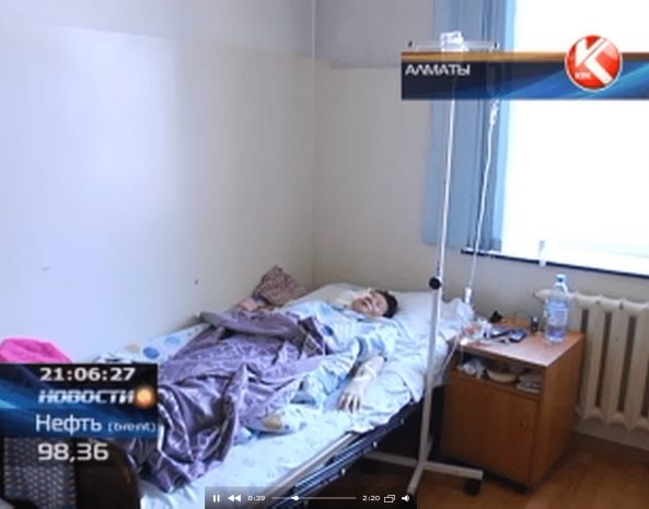 Впервые в Казахстане пациентке пересадили лицо