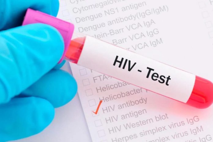 Более 660 фактов заболевания ВИЧ зарегистрировано в Мангыстау