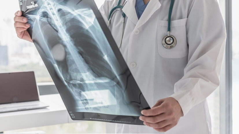 Рост заболеваемости туберкулезом зафиксирован среди студентов Астаны