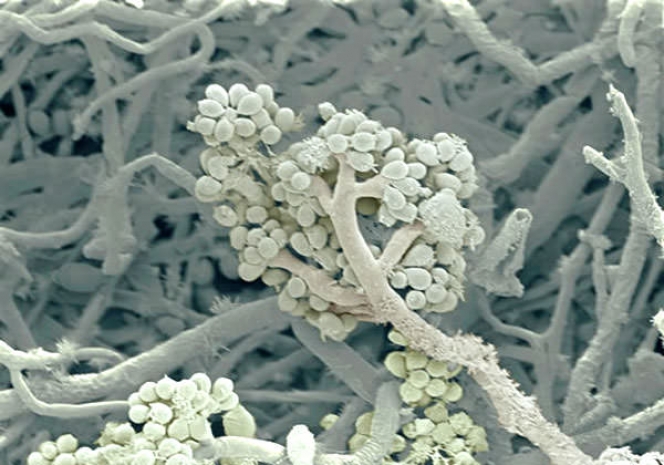 Чем опасна плесень?