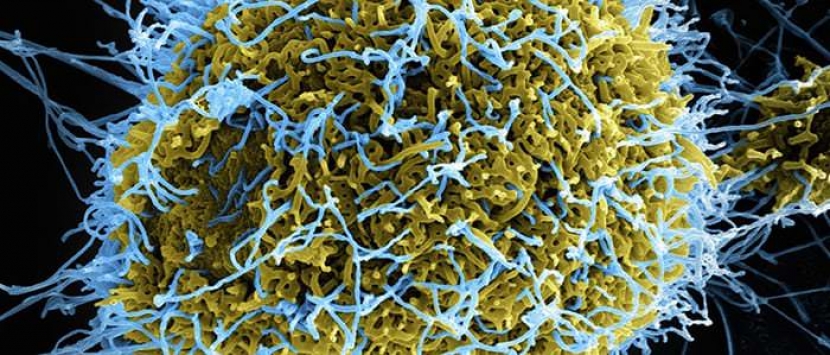 Новосибирские ученые разрабатывают вакцину против вируса Эбола