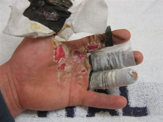 Двое детей получили ожоги от петард в ЗКО