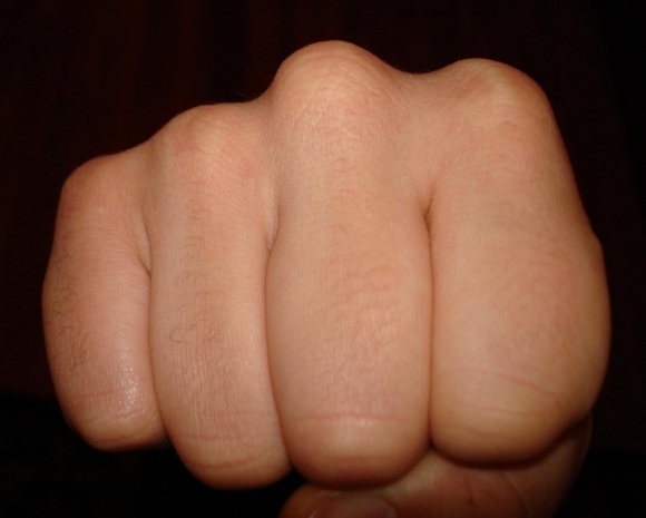 Ударивший девушку кулаком в лицо мужчина состоит на учете в Атырау