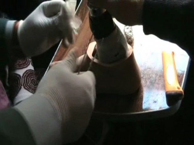 Тайник для наркотиков перевозчик сделал в протезе ноги. Фото