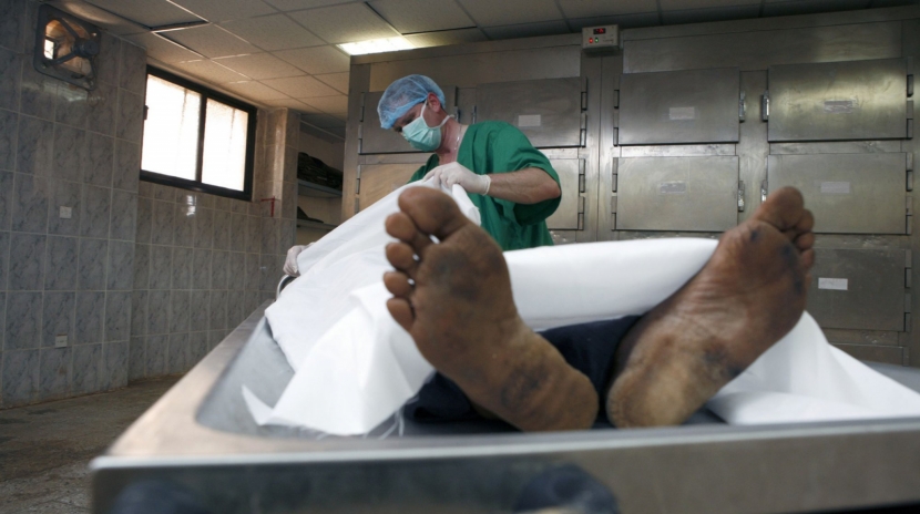 В испанской тюрьме патологоанатомы хотели разрезать живого человека