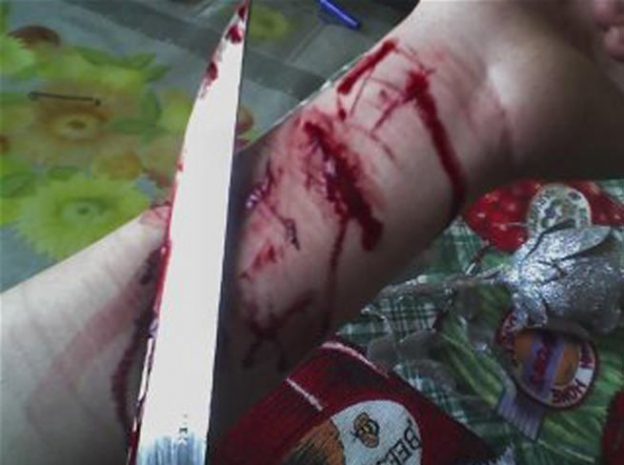 В РК зарегистрировано 10 случаев суицида на 100 тысяч подростков