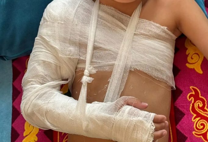 Ақтауда сегіз жасар балаға темір қоршаудың бір бөлігі құлады