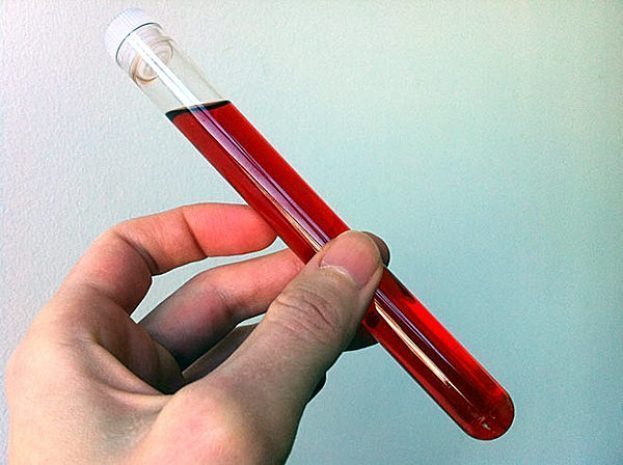 Чистить кровь полезно?