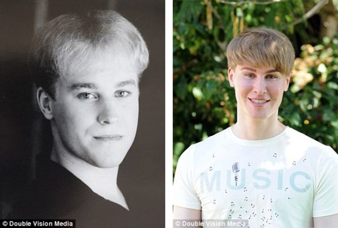 Американец купил себе лицо Джастина Бибера за $100 тысяч