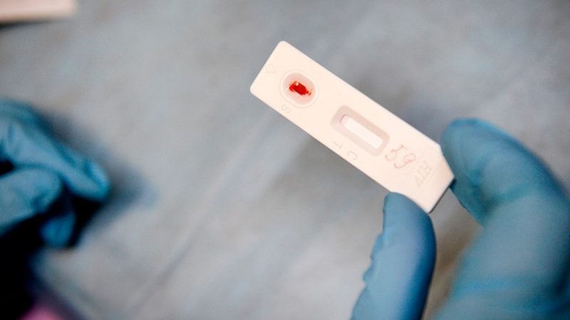 Египет выдворяет иностранцев с диагнозом ВИЧ