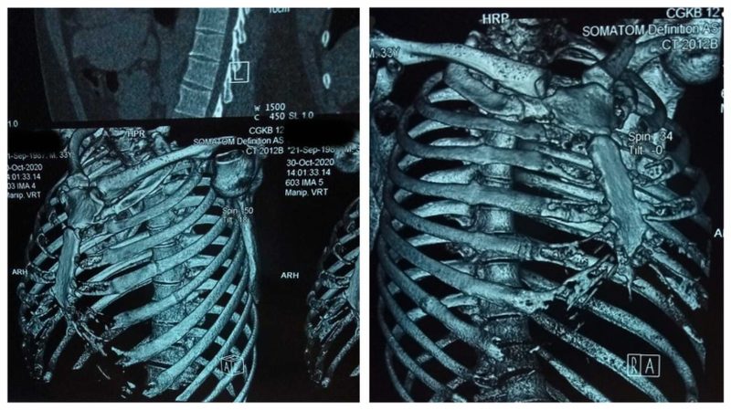 Больного шизофренией подвергали пыткам за преступление, которое не совершал — правозащитник